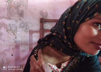 भारतको खुटौना लगेर श्रीमान मो.समरुल मियां र देवर मो. नइमले निर्घात कुटपिट: न्याय खोज्दै पीडित महिला