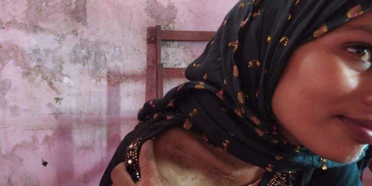 भारतको खुटौना लगेर श्रीमान मो.समरुल मियां र देवर मो. नइमले निर्घात कुटपिट: न्याय खोज्दै पीडित महिला