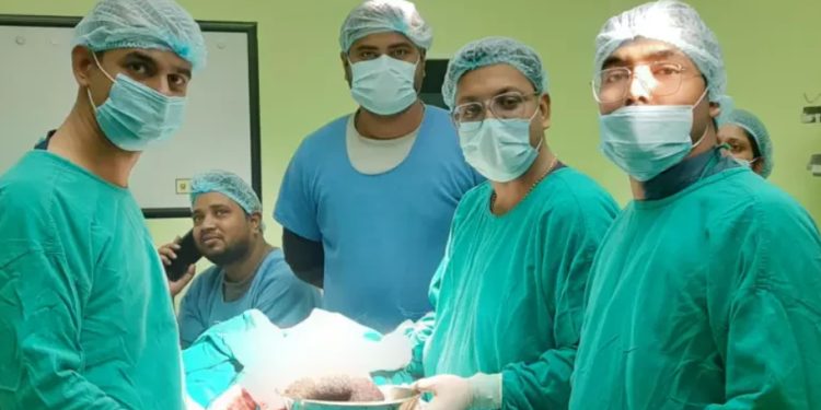 ९ वर्षीया बालिकाको पेटबाट १ किलो कपालको डल्लो निकालियो