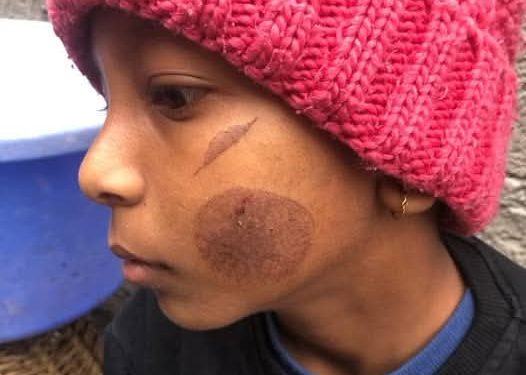 विद्यार्थीमाथि निर्घात दुर्व्यवहार: तातो पन्यूले डाम्ने शिक्षिका प्रहरी नियन्त्रणमा