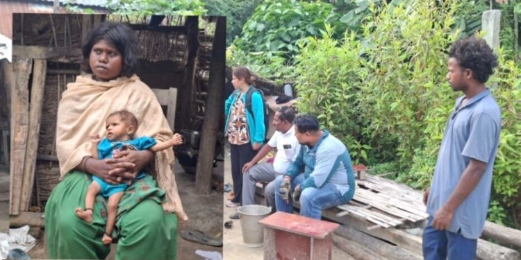 सप्तरीमा १० महिने बालिकामा कडा शीघ्र कुपोषण, उपचारको पर्खाइमा सदा परिवार